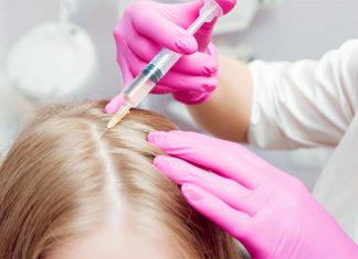 Włos w stanie upadku: co mu pomoże? Mezoterapia włosów vs. olejowanie